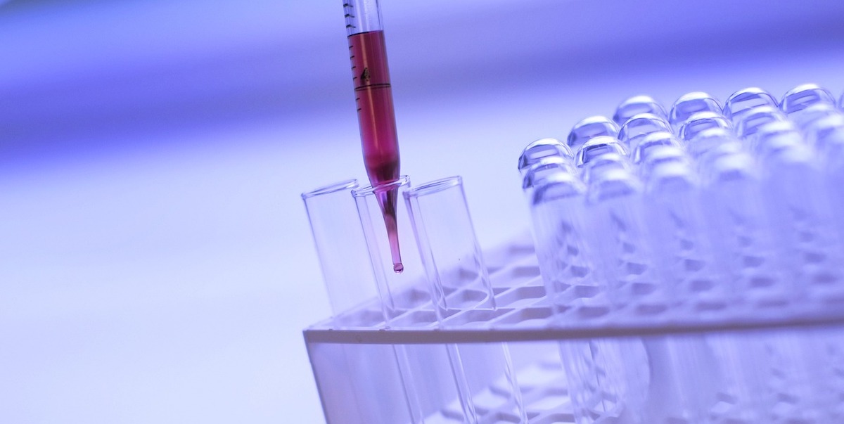 Colorectal cancer screening, simple, free, saves lives Archyde